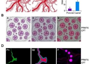 PRMT6 Promotes Blood Vessel Growth in Colorectal Cancer
