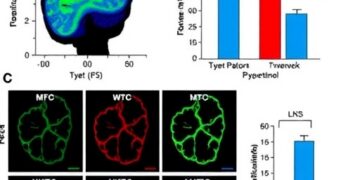 Pycnogenol Reduces Neurobehavioral and Liver Damage from Thioacetamide Exposure