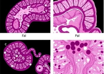 Routine duodenal papillary biopsy enhances detection of duodenal papillary adenoma in familial adenomatous polyposis patients: a prospective cohort study