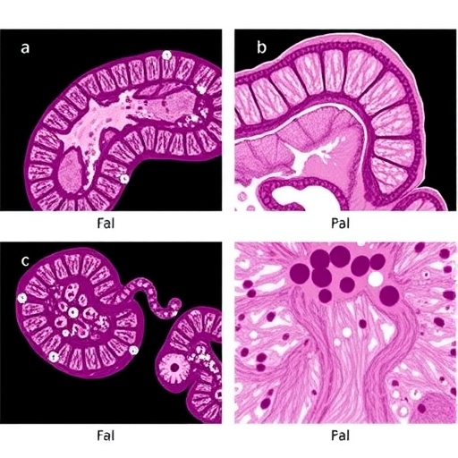 Routine duodenal papillary biopsy enhances detection of duodenal papillary adenoma in familial adenomatous polyposis patients: a prospective cohort study