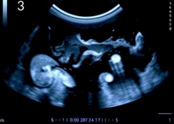 Standardizing Lung Ultrasound to Improve Neonatal Care Outcomes