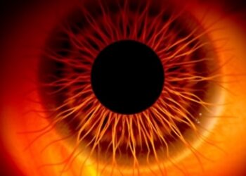 Stem Cell Therapy Shows One-Year Survival in Retinitis Pigmentosa Patients