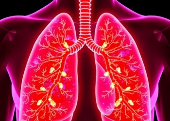 Study shows lung tumors hijack nervous system to starve body