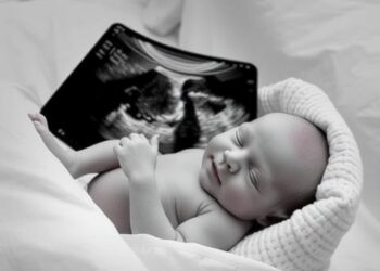 Study Shows Lung Ultrasound Can Guide PEEP Adjustments in Newborns