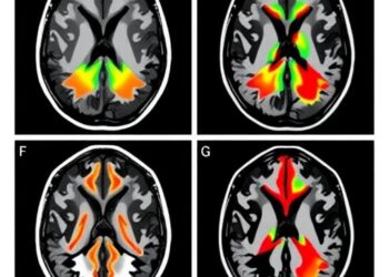 The cross-site reproducibility of MRI morphometric phenotypes in psychiatric disorders