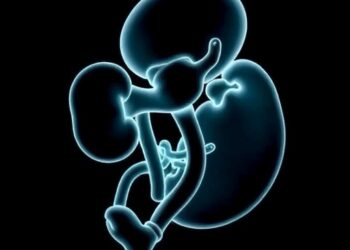 Transcatheter PDA Closure Effects on Kidney Function in Tiny Preemies