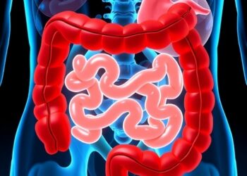Treatment delays in colorectal cancer linked to higher metastasis risk thresholds