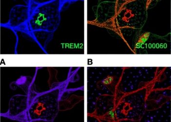 TREM2-S100A9 axis drives pro-tumor macrophages, making ovarian cancer responsive to IL-17 blockade.