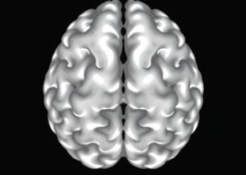 White Matter Microstructure and Brain Network Changes in Children With Global Developmental Delay