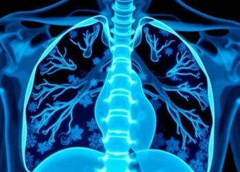 YEARS Algorithm Enhances Pulmonary Embolism Diagnosis in Cancer Patients