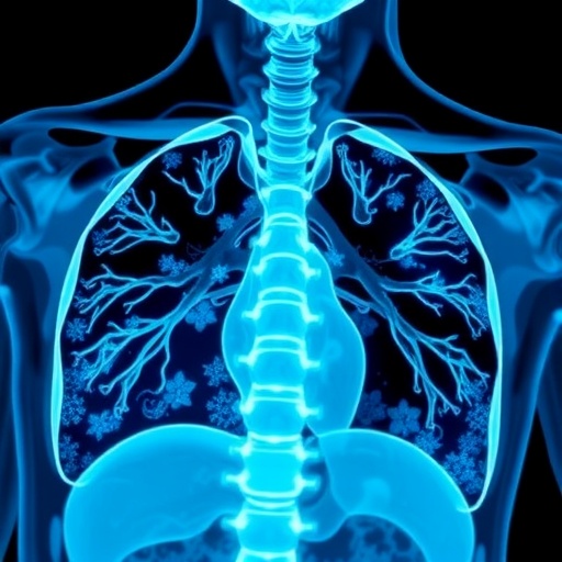 YEARS Algorithm Enhances Pulmonary Embolism Diagnosis in Cancer Patients