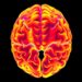 3D imaging maps glioma infiltration and tumor boundaries within 30 minutes