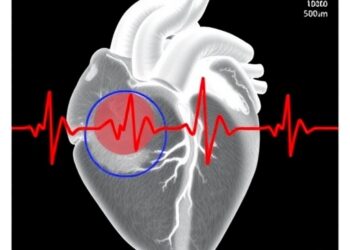 Accounting for Model Uncertainty Improves Ventricular Tachycardia Ablation Guidance