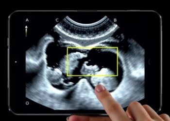 Affordable handheld 3D ultrasound reconstruction system developed with visual positioning