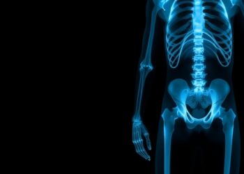Affordable Lead Screening Using Transmission X-Ray Fluorescence