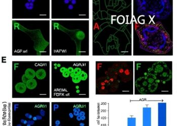 AGR2-high cells fuel FOXM1-driven malignancy and predict outcomes in pancreatic neuroendocrine tumors