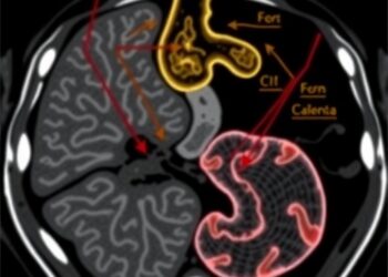 AI blends CT imaging and gene data to predict gastric cancer survival
