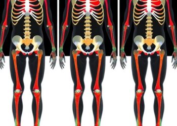 AI Ensemble Automatically Classifies Musculoskeletal Abnormalities Using Multiple Deep Vision Models