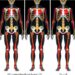 AI Ensemble Automatically Classifies Musculoskeletal Abnormalities Using Multiple Deep Vision Models