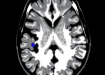 AI Framework Unifies MRI Tumor Segmentation, Grading, Staging, and Malignancy Detection