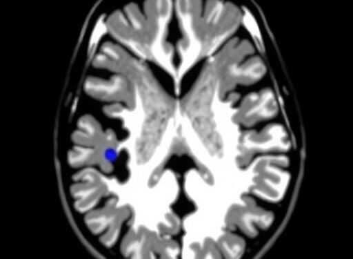 AI Framework Unifies MRI Tumor Segmentation, Grading, Staging, and Malignancy Detection