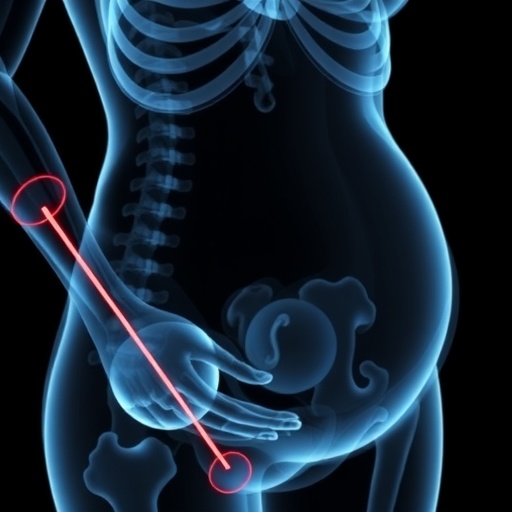 Radiographic Analysis Links Heparin in Pregnancy to Reduced Maternal