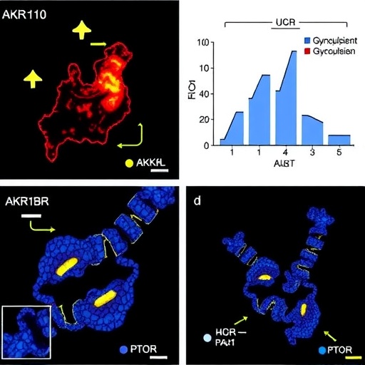 AKR1B10 Drives Breast Cancer Glycolysis and Growth Through IGF2R-PGK1-H4K12la-mTOR Signaling