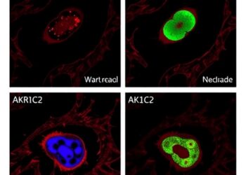 AKR1C2 Drives Cervical Cancer Lymph Node Metastasis Through Noncanonical Nuclear Activity