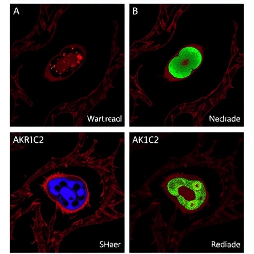 AKR1C2 Drives Cervical Cancer Lymph Node Metastasis Through Noncanonical Nuclear Activity