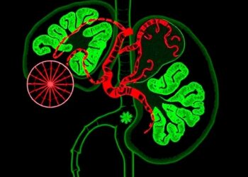 Alcohol reshapes liver zonation and immune-metabolic programming in metabolic syndrome-associated liver cancer