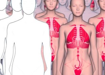 Alveolar Capillary Dysplasia: How Health System Data Illuminate Rare Disease