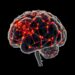 AlzheiNN: Convolutional Neural Network Model Classifies Alzheimer’s Disease