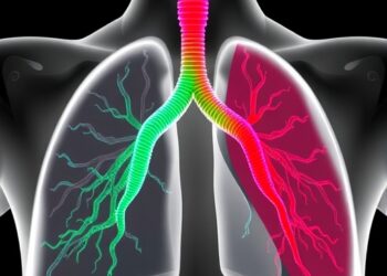 Amiloride Eases Respiratory Distress from WFDC2 Deficiency by Blocking Epithelial Sodium Channels