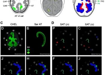 Bispecific CAR T Cells Eliminate AChR-Specific B Cells in Myasthenia Gravis Models