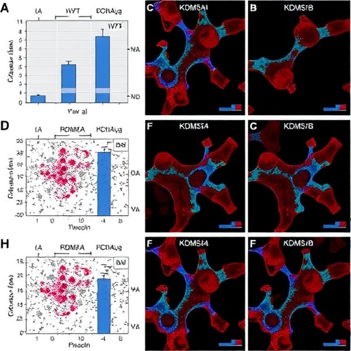 Blocking KDM5A/B boosts antitumor immune responses in HHV-8-positive B-cell lymphomas