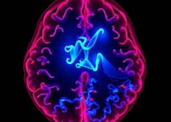 Brain and Retina Prion Protein Show Distinctive Features in PRNP F198S Amyloidosis