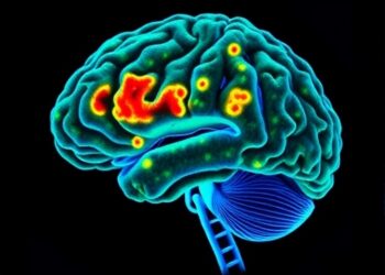 Brain-region microstructure and gene activity reveal Alzheimer’s neurodegeneration