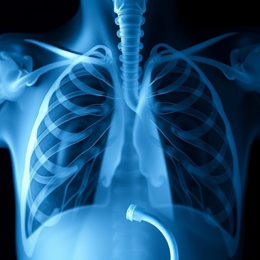 Bronchopulmonary Dysplasia Linked to Invasive Ventilation and Greater Respiratory Support