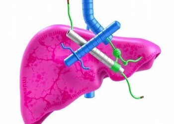 Cadonilimab, Lenvatinib, TACE Show Promise in Unresectable Liver Cancer