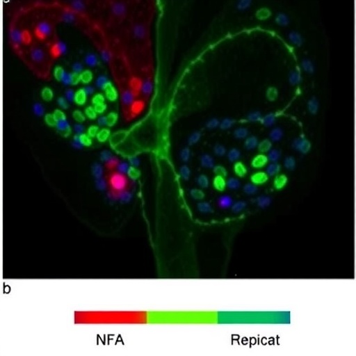 Cancer-associated fibroblast SERPINH1 drives epithelial-mesenchymal transition in clear cell kidney cancer