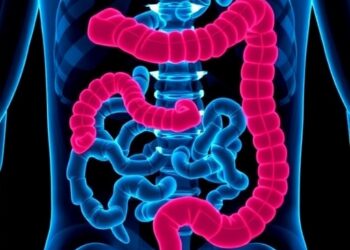 Colorectal cancer screening may cut mortality by more than 40%