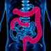 Colorectal cancer screening may cut mortality by more than 40%