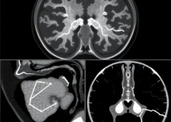 Comprehensive Review of Benchmark Datasets for Deep Learning in Medical Image Segmentation