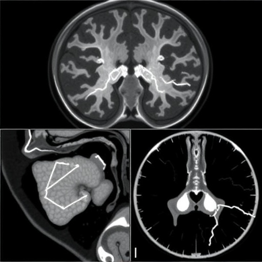 Comprehensive Review of Benchmark Datasets for Deep Learning in Medical Image Segmentation
