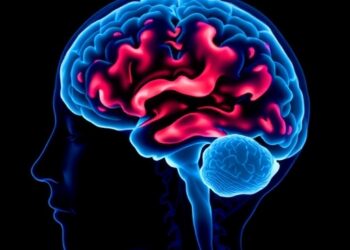 Cortical thinning precedes high amyloid levels by at least seven years