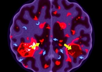 Covalent PFKL activator suppresses tumor growth