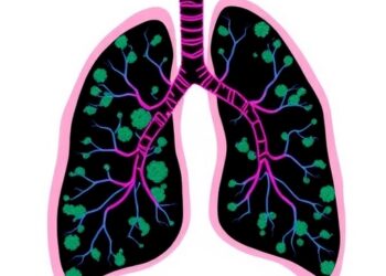 CTPS1 Drives Lung Adenocarcinoma Progression, Revealing a Targetable Vulnerability