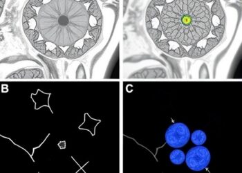 Cytotoxic CD4+ T Cells Drive Age-Related Myelopoiesis via CCL5–CCR5 Signaling