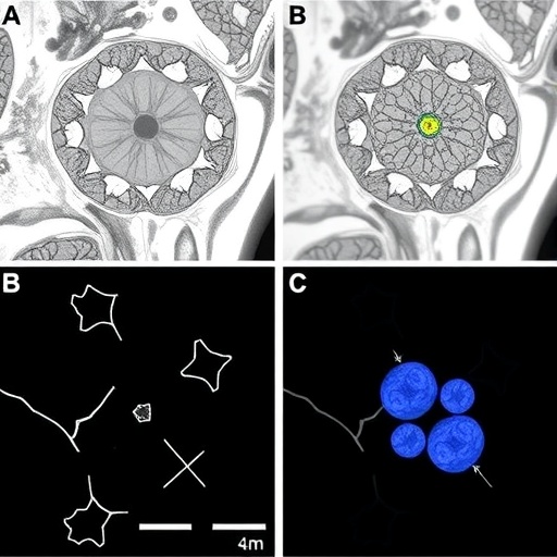 Cytotoxic CD4+ T Cells Drive Age-Related Myelopoiesis via CCL5–CCR5 Signaling