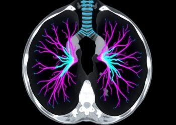Deep Learning Advances Lung Cancer Segmentation and Volumetric Analysis in CT Scans